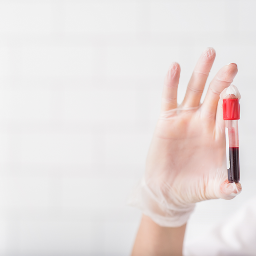 Hypothyroidism Treatment